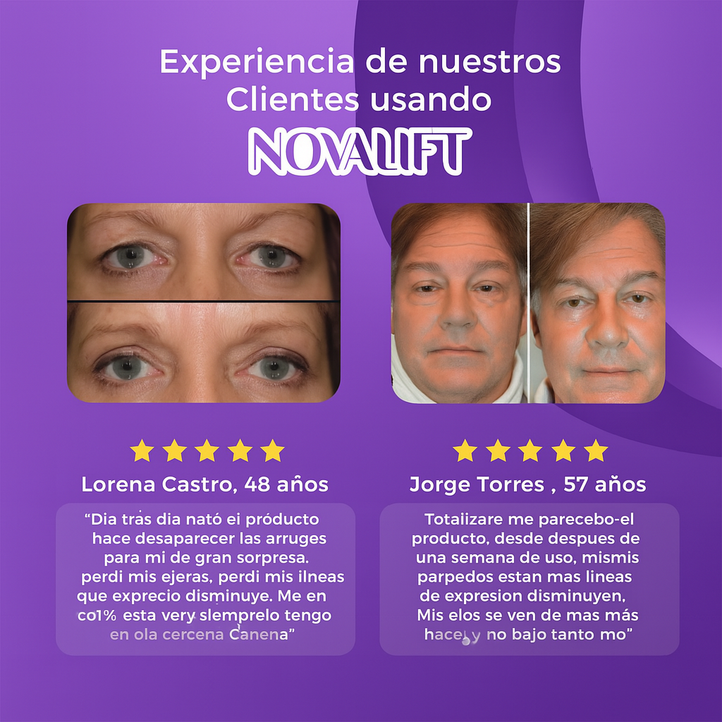 NovaLift© - Elimina ojeras y bolsas en solo 7 días - Zentra