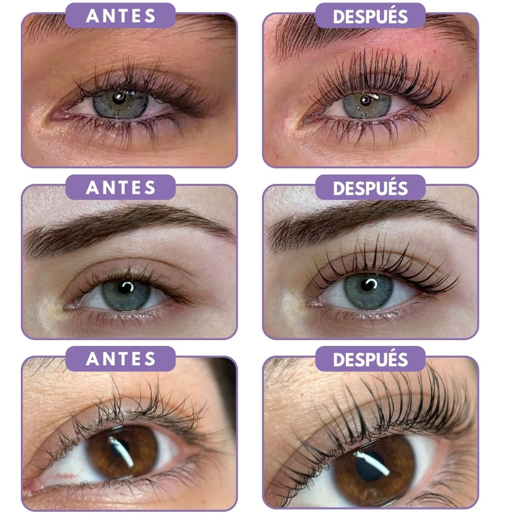 LashBoost© - Recupera Cejas y Pestañas Pobladas en 14 Días - Zentra