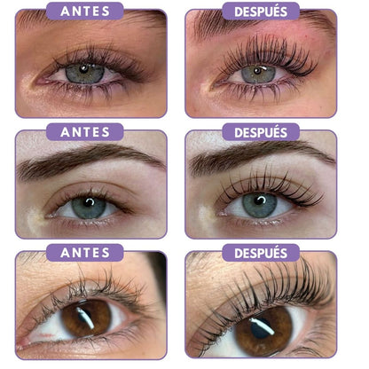 LashBoost© - Recupera Cejas y Pestañas Pobladas en 14 Días - Zentra
