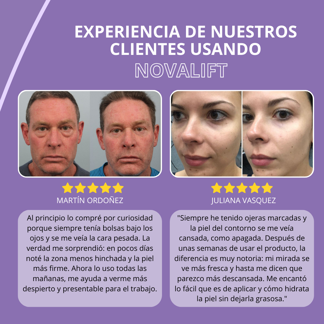 NovaLift© - Elimina ojeras y bolsas en solo 7 días - Zentra