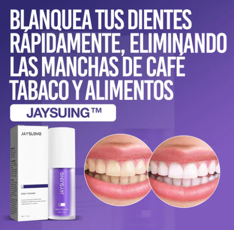 Blanqueador Dental V34 - JAYSUING™